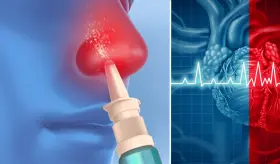 Aerosol nasal resulta efectivo para tratar episodios de ritmo cardíaco anormal o taquicardia 