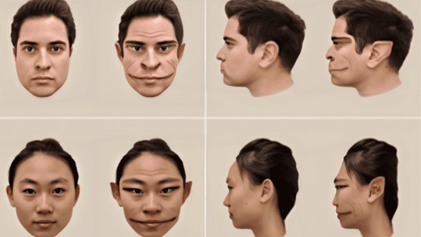 Prosopometamorfopsia o síndrome de Alicia en el País de las Maravillas: el trastorno que deforma rostro Prosopometamorfopsia o síndrome de Alicia en el País de las Maravillas: el trastorno que deforma rostro