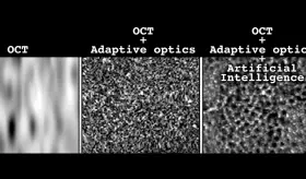 Inteligencia artificial 100 veces m&aacute;s r&aacute;pida para obtener im&aacute;genes celulares del ojo y detectar enfermedades
