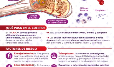 Leucemia mieloide aguda | Infograf&iacute;a
