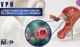 VPH: ¿Cómo puede causar cáncer de cérvix o cuello uterino? - #ExclusivoMSP