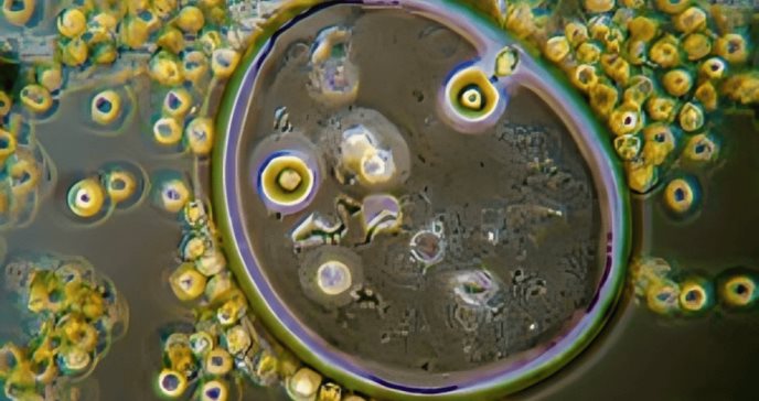 La secuenciación metagenómica de próxima generación revoluciona diagnóstico de infecciones neurológicas