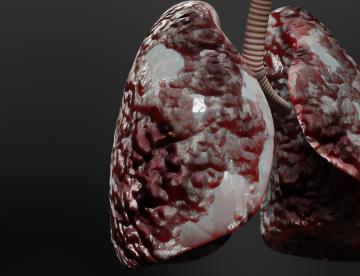 Identifican la forma de romper ciclo inflamatorio del asma y evitar el daño pulmonar