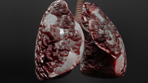 Identifican la forma de romper ciclo inflamatorio del asma y evitar el daño pulmonar Identifican la forma de romper ciclo inflamatorio del asma y evitar el daño pulmonar