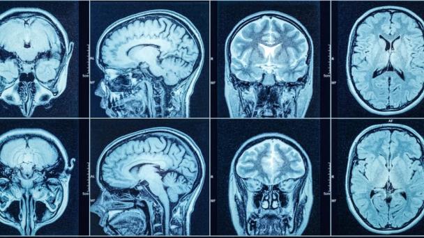 Dormir funcionaría como un “reinicio” del cerebro para el aprendizaje futuro