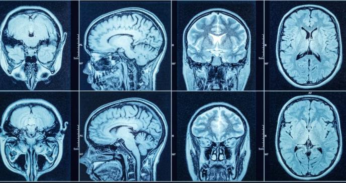 Dormir funcionaría como un “reinicio” del cerebro para el aprendizaje futuro