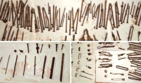 Mujer ingresa a urgencias con 170 piezas metálicas que ingirió en una crisis de esquizofrenia