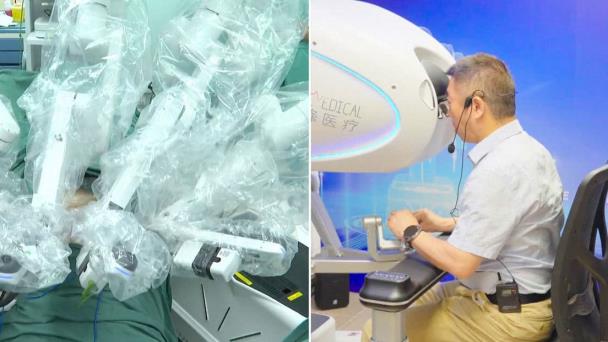 Médico realiza primera telecirugía de extirpación de próstata a paciente en China desde Italia Médico realiza primera telecirugía de extirpación de próstata a paciente en China desde Italia