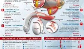 Prostatitis | Infografía