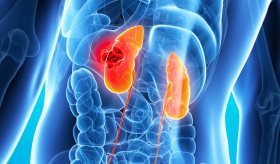 Desarrollan nueva terapia de anticuerpos eficaz para cáncer de riñón uniendo células T con células tumorales