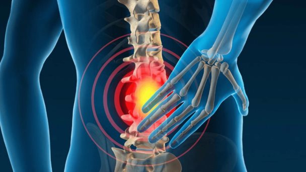 Nuevo estudio evidencia relación entre el estrés laboral y el dolor lumbar crónico