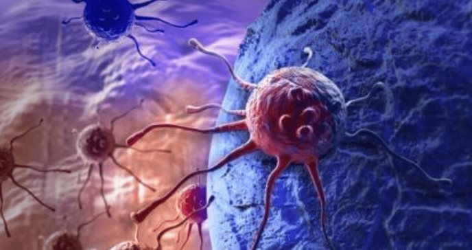 Incluyen nanopartículas que aumentan la eficacia del tratamiento contra el cáncer de colon 