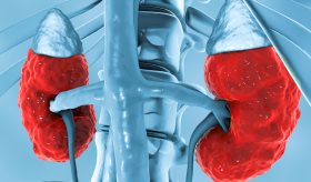 Enfermedad renal crónica se ha convertido en una epidemia progresiva que empeora en América Latina