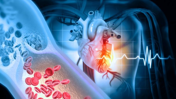 Un mortal “reto fitness”: ¿Por qué sumergirse en agua con hielo podría aumentar el riesgo de infarto? 