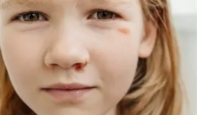 Maltrato infantil podr&iacute;a afectar la salud en la adultez generando obesidad y problemas en sistema inmune