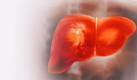 Metronidazol, fluconazol y claritromicina dentro de 17 medicamentos más potencialmente hepatotóxicos