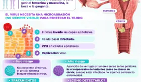 Virus Del Papiloma Humano
