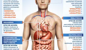 Antidiabéticos orales | Infografía