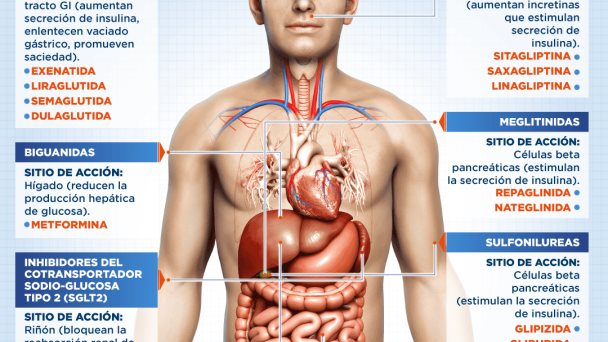 Antidiabéticos orales | Infografía Antidiabéticos orales | Infografía