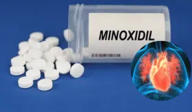 Advierten sobre los posibles efectos adversos del consumo de minoxidil oral por prescripción