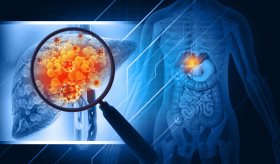 Obesidad, hipertensión y diabetes: Comorbilidades de hígado graso no alcohólico comunes en Puerto Rico