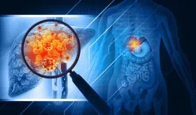 Obesidad, hipertensión y diabetes: Comorbilidades de hígado graso no alcohólico comunes en Puerto Rico