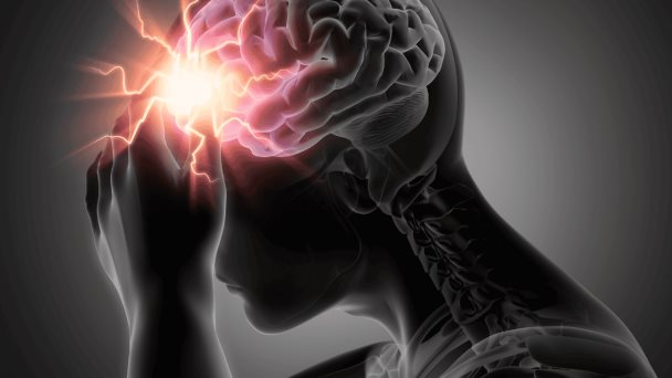 Omeprazol y esomeprazol podrían desencadenar migrañas, según estudio Omeprazol y esomeprazol podrían desencadenar migrañas, según estudio
