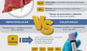 Elevación de las pruebas de la función hepática | Infografía