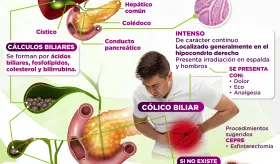 Sistema biliar | Infografía