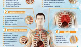 Posibles causas del dolor torácico en su relación con la localización | Infografía