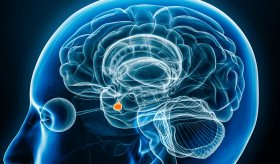 Cara de luna y síndrome de Cushing: importancia del diagnóstico temprano y tratamiento especializado