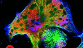 Nueva técnica de imagen molecular detecta el neuroblastoma infantil con alta precisión