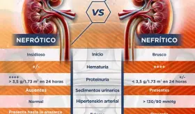 Síndrome nefrótico y nefrítico | Infografía