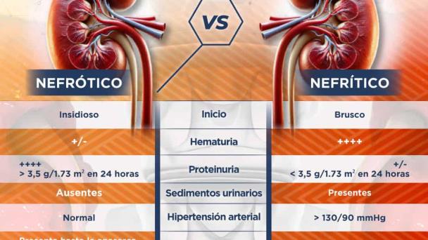 Síndrome nefrótico y nefrítico | Infografía
