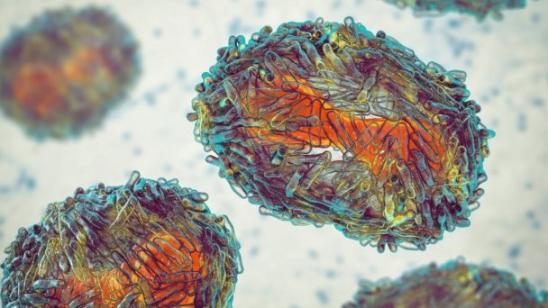 Mpox: Sin riesgo de convertirse en una nueva pandemia como el COVID-19 Mpox: Sin riesgo de convertirse en una nueva pandemia como el COVID-19