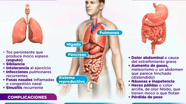 Día mundial de la fibrosis quística | Infografía Día mundial de la fibrosis quística | Infografía