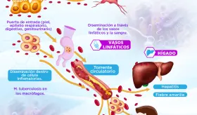 Vías de entrada y diseminación de los microbios | Infografía