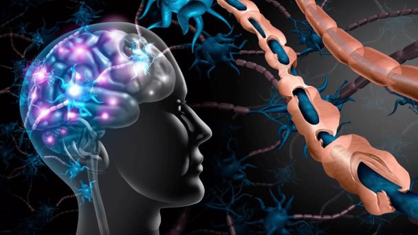 “Necesariamente, los pacientes de esclerosis múltiple se han infectado del virus de Epstein-Barr” “Necesariamente, los pacientes de esclerosis múltiple se han infectado del virus de Epstein-Barr”