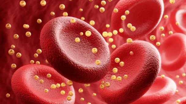 Lipoproteína(a): generalmente es asintomática, pero puede aumentar el riesgo de infartos Lipoproteína(a): generalmente es asintomática, pero puede aumentar el riesgo de infartos