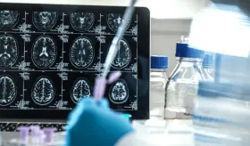 Nueva generación de radiofármacos ataca al cáncer con precisión molecular y reduce efectos secundarios 