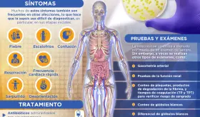Día mundial de la sepsis | Infografía