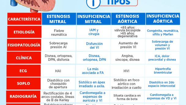 Valvulopatías | Infografía Valvulopatías | Infografía