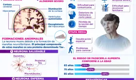 Día mundial del Alzheimer | Infografía