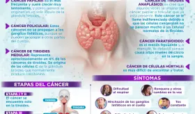 Cáncer de tiroides | Infografía