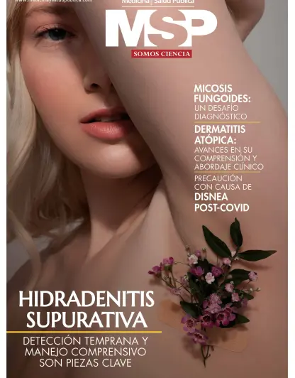 HIDRADENITIS
SUPURATIVA: DETECCIÓN TEMPRANA Y
MANEJO COMPRENSIVO
SON PIEZAS CLAVE