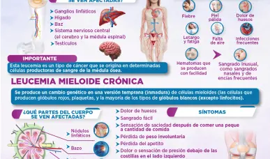 Leucemia mieloide aguda vs cr&oacute;nica