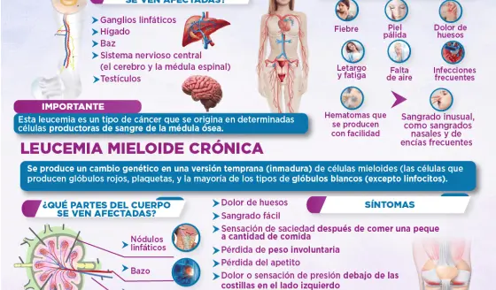 Leucemia mieloide aguda vs crónica