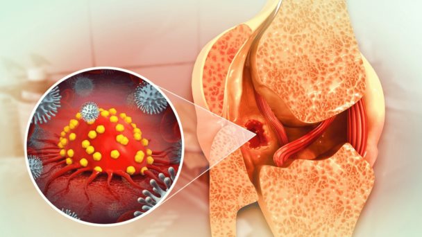 Un aumento en proteínas óseas podría predecir el riesgo cardiovascular incluso hasta diez años antes Un aumento en proteínas óseas podría predecir el riesgo cardiovascular incluso hasta diez años antes
