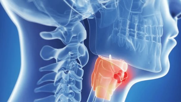 Descubren vínculo entre enfermedad periodontal y el riesgo de cáncer de cabeza y cuello Descubren vínculo entre enfermedad periodontal y el riesgo de cáncer de cabeza y cuello