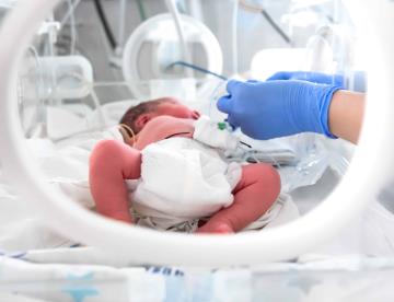 Demuestran niveles indetectables de VIH en 5 menores que recibieron terapia antirretroviral intermitente